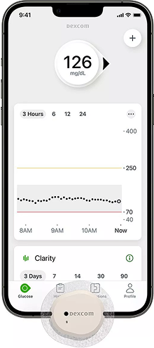 Dexcom G7 sensor with iPhone