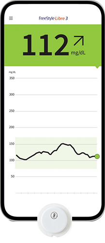 Freestyle Libre 3 Plus sensor with smartphone